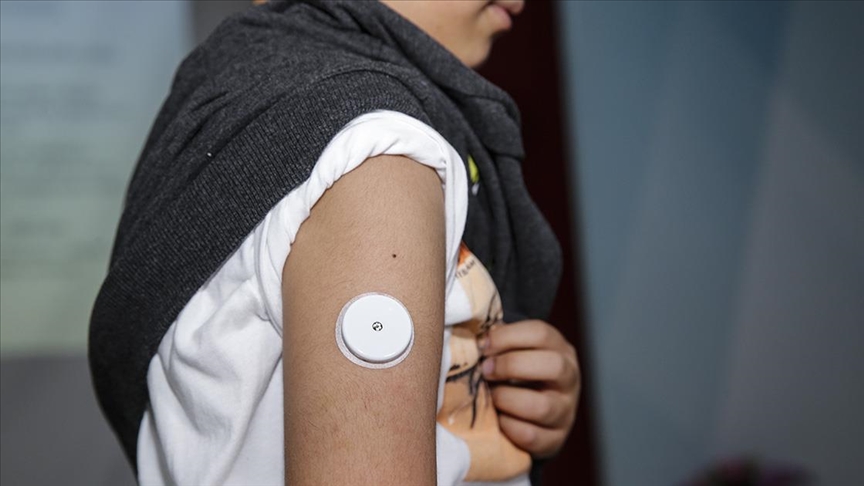 Cocuk Diyabet Sensor Destegi